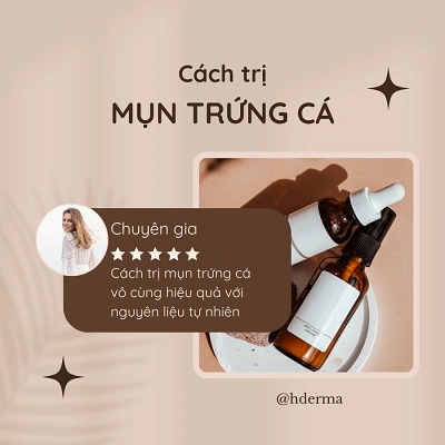Hướng dẫn từng bước điều trị mụn trứng cá tại nhà hiệu quả