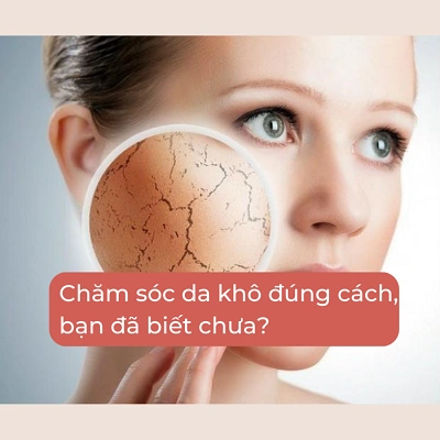 DẤU HIỆU NHẬN BIẾT VÀ CÁCH CHĂM SÓC DA KHÔ?