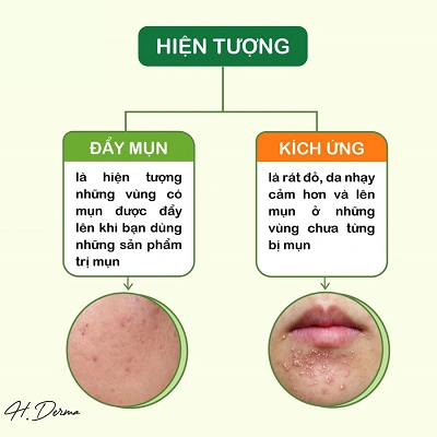 Hướng dẫn phân biệt đẩy mụn và kích ứng da chuẩn nhất