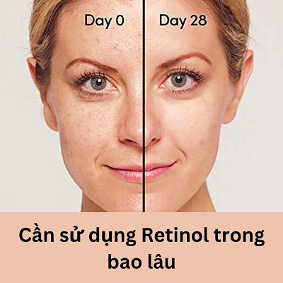 Cần sử dụng Retinol trong bao lâu để đạt được hiệu quả?