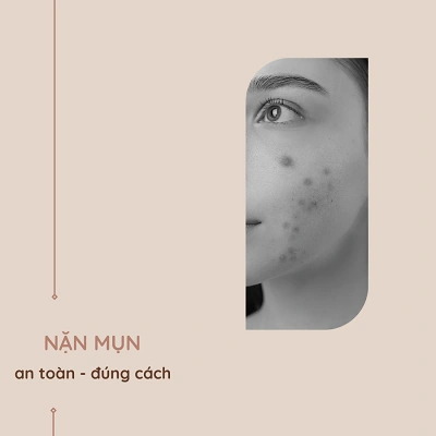 Nặn mụn có nên không? 5 bước nặn mụn an toàn không sẹo