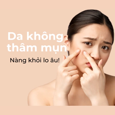 Phục hồi da sau nặn mụn không để lại thâm